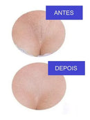 Adesivo Reutilizavel Anti Idade Rugas Silicone